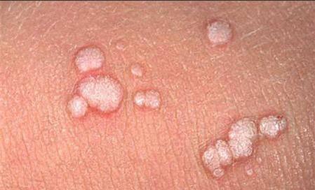 Mẹo làm đẹp với đu đủ xanh cực hay
