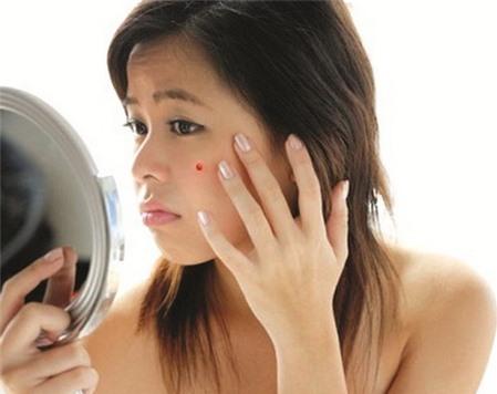 Bà bầu bị mụn nhọt phải làm sao?